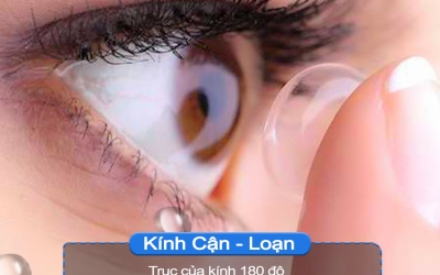 Lens cận loạn 